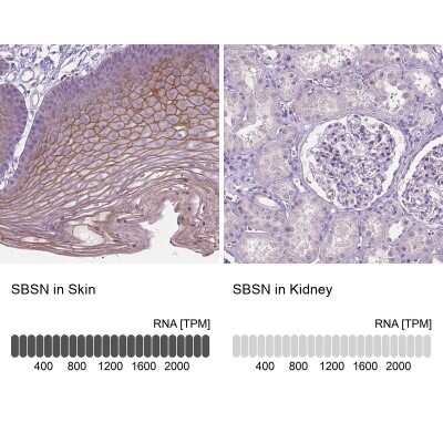 Immunohistochemistry-Paraffin: SBSN Antibody [NBP2-49369]