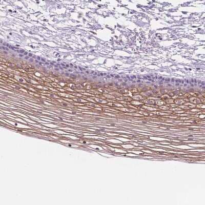 Immunohistochemistry-Paraffin: SBSN Antibody [NBP2-49369]