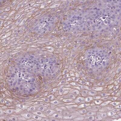 Immunohistochemistry-Paraffin: SBSN Antibody [NBP2-49369]