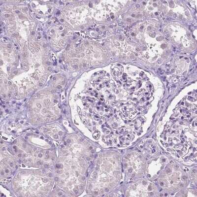 Immunohistochemistry-Paraffin: SBSN Antibody [NBP2-49369]