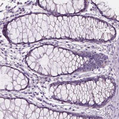 Immunohistochemistry-Paraffin: SBSN Antibody [NBP2-49369]