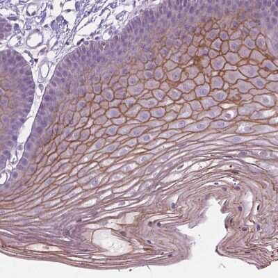 Immunohistochemistry-Paraffin: SBSN Antibody [NBP2-49369]