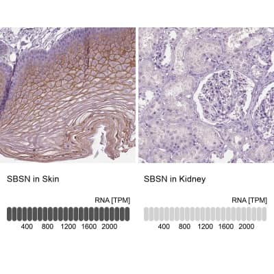 Immunohistochemistry-Paraffin: SBSN Antibody [NBP2-49528]