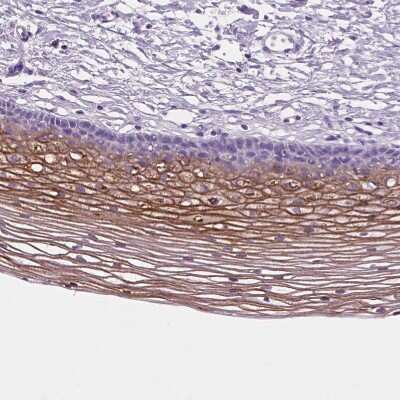 Immunohistochemistry-Paraffin: SBSN Antibody [NBP2-49528]