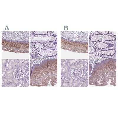 Immunohistochemistry-Paraffin: SBSN Antibody [NBP2-49528]