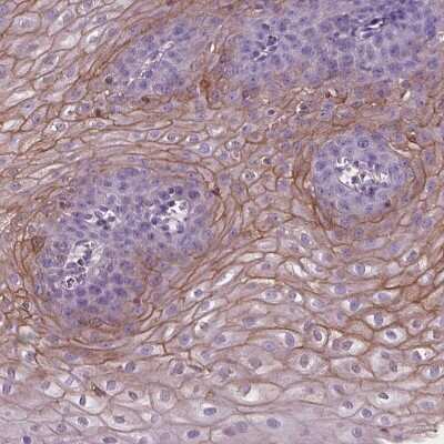 Immunohistochemistry-Paraffin: SBSN Antibody [NBP2-49528]
