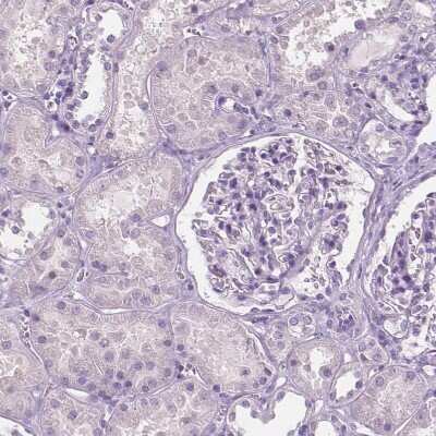 Immunohistochemistry-Paraffin: SBSN Antibody [NBP2-49528]