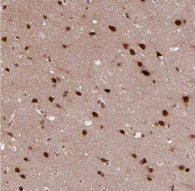 Immunohistochemistry-Paraffin: SC35 Antibody [NBP2-47290]