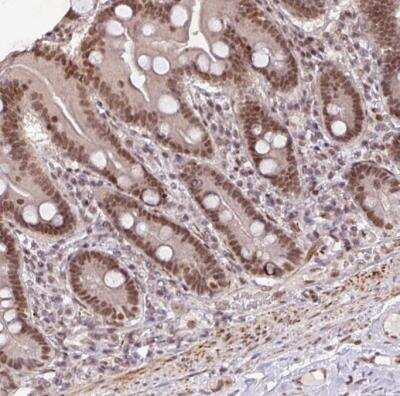 Immunohistochemistry-Paraffin: SC35 Antibody [NBP2-47290]