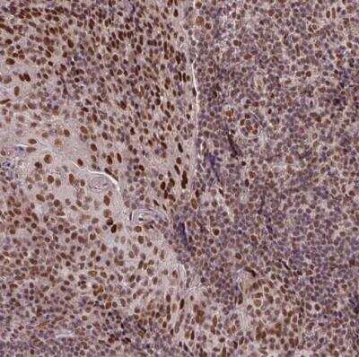 Immunohistochemistry-Paraffin: SC35 Antibody [NBP2-47290]
