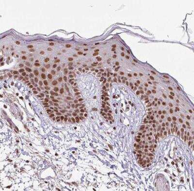 Immunohistochemistry-Paraffin: SC35 Antibody [NBP2-47290]