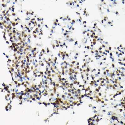 Immunohistochemistry-Paraffin: SC35 Antibody - Azide and BSA Free [NBP2-94309]