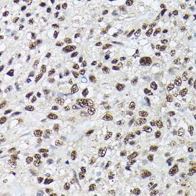 Immunohistochemistry-Paraffin: SC35 Antibody - Azide and BSA Free [NBP2-94309]