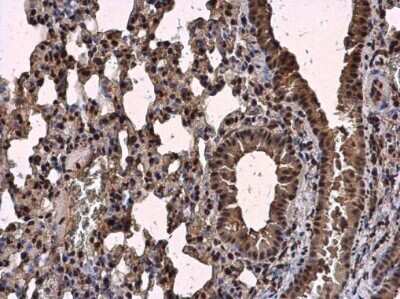 Immunohistochemistry-Paraffin: SC35 Antibody [NBP3-12974]