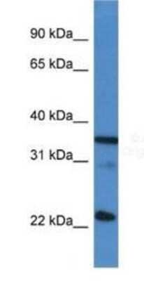 Western Blot: SC35 Antibody [NBP1-79886]