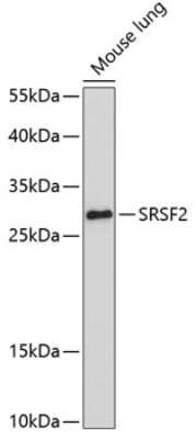 Western Blot: SC35 AntibodyAzide and BSA Free [NBP2-94309]