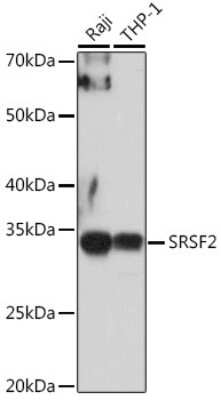 Western Blot: SC35 AntibodyAzide and BSA Free [NBP2-94309]