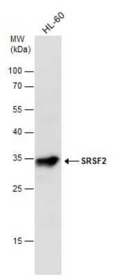 Western Blot: SC35 Antibody [NBP3-12974]