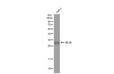 Western Blot: SC35 Antibody [NBP3-12974]