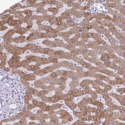 Immunohistochemistry: SC4MOL Antibody [NBP2-31624]