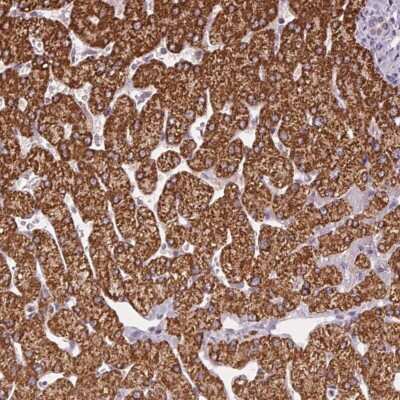 Immunohistochemistry: SC5DL Antibody [NBP2-49478]