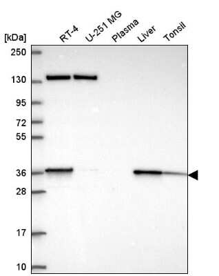 Western Blot: SC5DL Antibody [NBP2-55973]