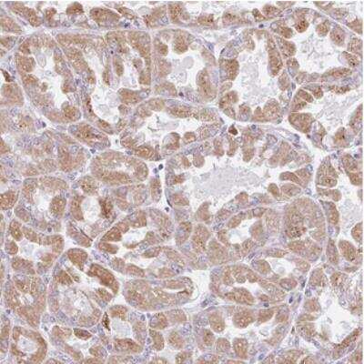 Immunohistochemistry: SCA31 Antibody [NBP2-30872]