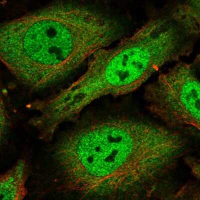 Immunocytochemistry/ Immunofluorescence: SCAF1 Antibody [NBP2-56765]