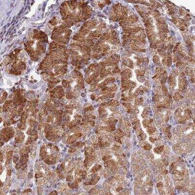 Immunohistochemistry-Paraffin: SCAF1 Antibody [NBP1-94048]