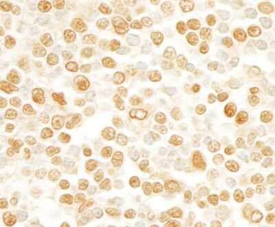 Immunohistochemistry-Paraffin: SCAF11/SFRS2IP Antibody [NB100-55266]