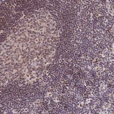 Immunohistochemistry-Paraffin: SCAF11/SFRS2IP Antibody [NBP1-86620]