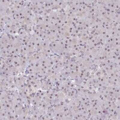 Immunohistochemistry-Paraffin: SCAF11/SFRS2IP Antibody [NBP1-86620]