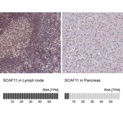 Immunohistochemistry-Paraffin: SCAF11/SFRS2IP Antibody [NBP1-86620]