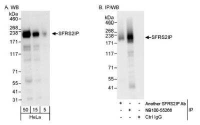 Western Blot: SCAF11/SFRS2IP Antibody [NB100-55266]