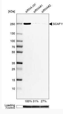 Western Blot: SCAF11/SFRS2IP Antibody [NBP2-55598]