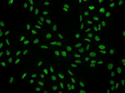 Immunocytochemistry/ Immunofluorescence: SCAF8/RBM16 Antibody [NBP3-05864]