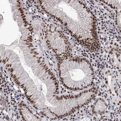 Immunohistochemistry: SCAF8/RBM16 Antibody [NBP2-34015]