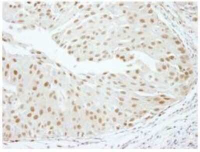 Immunohistochemistry-Paraffin: SCAF8/RBM16 Antibody [NB100-55330]