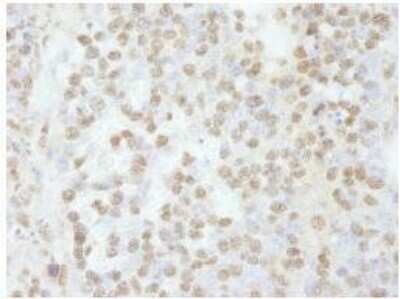 Immunohistochemistry-Paraffin: SCAF8/RBM16 Antibody [NB100-55330]