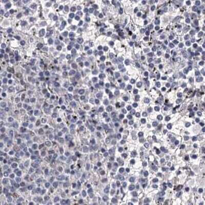Immunohistochemistry-Paraffin: SCAF8/RBM16 Antibody [NBP2-34015]
