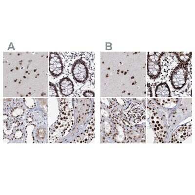 Immunohistochemistry-Paraffin: SCAF8/RBM16 Antibody [NBP2-34015]