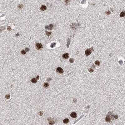Immunohistochemistry-Paraffin: SCAF8/RBM16 Antibody [NBP2-34015]