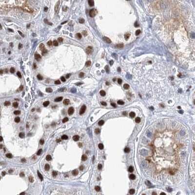 Immunohistochemistry-Paraffin: SCAF8/RBM16 Antibody [NBP2-34015]