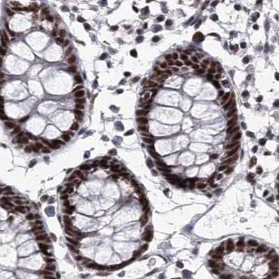Immunohistochemistry-Paraffin: SCAF8/RBM16 Antibody [NBP2-34015]