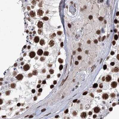Immunohistochemistry-Paraffin: SCAF8/RBM16 Antibody [NBP2-34015]