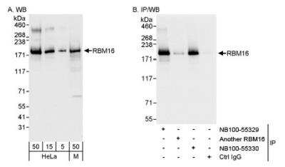 Western Blot: SCAF8/RBM16 Antibody [NB100-55329]