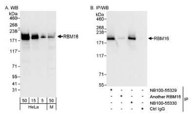 Western Blot: SCAF8/RBM16 Antibody [NB100-55330]