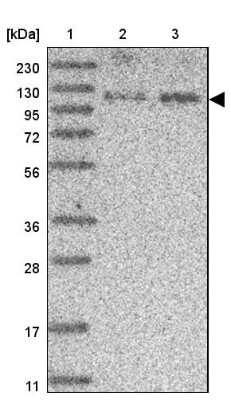 Western Blot: SCAF8/RBM16 Antibody [NBP2-34015]