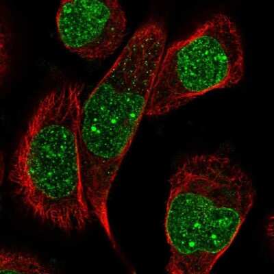 Immunocytochemistry/ Immunofluorescence: SCAI Antibody [NBP1-86711]