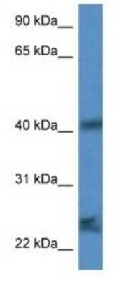 Western Blot: SCAMP1 Antibody [NBP1-79765]